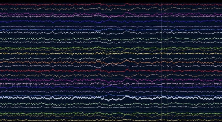 Digitalizando el cerebro